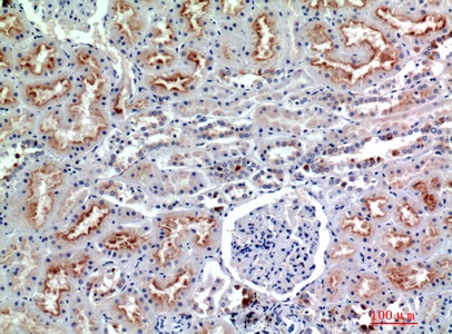 Fig.3. Immunohistochemical analysis of paraffin-embedded human-kidney, antibody was diluted at 1:200.