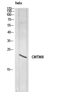 Fig.1. Western blot analysis of hela lysis using CMTM8 antibody. Secondary antibody (catalog#: A21020) was diluted at 1:20000.