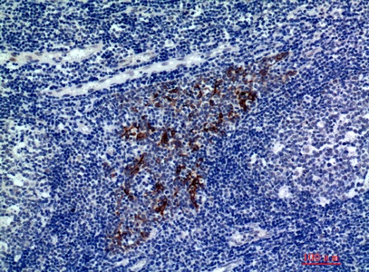 Fig.3. Immunohistochemical analysis of paraffin-embedded human-tonsils, antibody was diluted at 1:200.