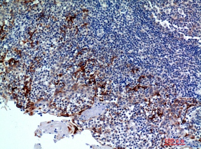 Fig.4. Immunohistochemical analysis of paraffin-embedded human-tonsils2,  antibody was diluted at 1:100.