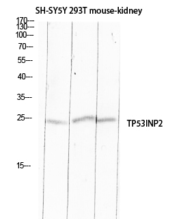 Fig.1. Western blot analysis of SH-SY5Y 293T Mouse-kidney lysis using TP53INP2 antibody. Antibody was diluted at 1:500. Secondary antibody (catalog#: A21020) was diluted at 1:20000.