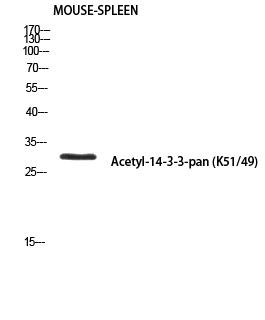 Fig. Western blot analysis of Mouse-SPLEEN using Acetyl-14-3-3-pan (K51/49) antibody. Antibody was diluted at 1:500. Secondary antibody (catalog#: A21020) was diluted at 1:20000.