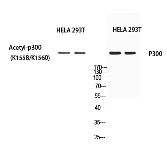 Fig. Western blot analysis of HELA 293T using Acetyl-p300 (K1558/K1560) antibody. Antibody was diluted at 1:500. Secondary antibody (catalog#: A21020) was diluted at 1:20000.
