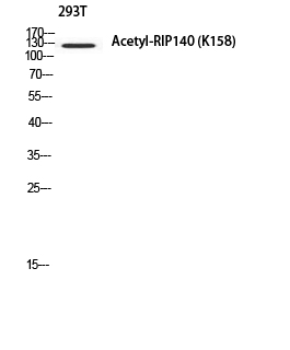 Fig. Western blot analysis of 293T using Acetyl-RIP140 (K158) antibody. Antibody was diluted at 1:500. Secondary antibody (catalog#: A21020) was diluted at 1:20000.