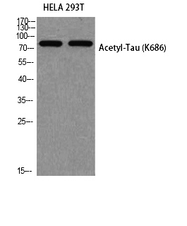 Fig. Western blot analysis of HELA 293T using Acetyl-Tau (K686) antibody. Antibody was diluted at 1:500. Secondary antibody (catalog#: A21020) was diluted at 1:20000.