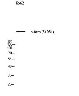 Fig. Western blot analysis of K562 using p-Atm (S1981) antibody. Antibody was diluted at 1:500.