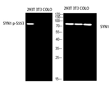 Fig. Western blot analysis of 293T using SYN1 p-S553 antibody. Antibody was diluted at 1:500.