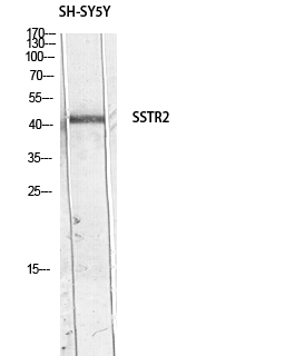 Fig. Western blot analysis of SH-SY5Y lysis using SSTR2 antibody. Antibody was diluted at 1:500. Secondary antibody (catalog#: A21020) was diluted at 1:20000.