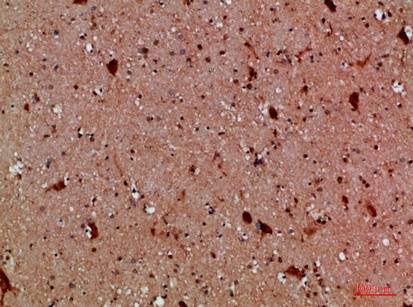 Fig.2. Immunohistochemical analysis of paraffin-embedded human-brain, antibody was diluted at 1:200.