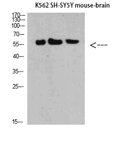 Fig.1. Western Blot analysis of K562 SH-SY5Y Mouse-brain cells using E-Selectin Polyclonal Antibody diluted at 1:500. Secondary antibody (catalog#: A21020) was diluted at 1:20000.