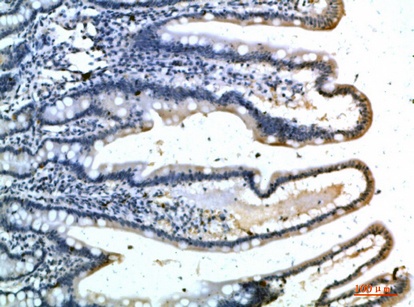 Fig.2. Immunohistochemical analysis of paraffin-embedded human-colon, antibody was diluted at 1:200.