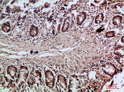 Fig.2. Immunohistochemical analysis of paraffin-embedded human-colon, antibody was diluted at 1:200.