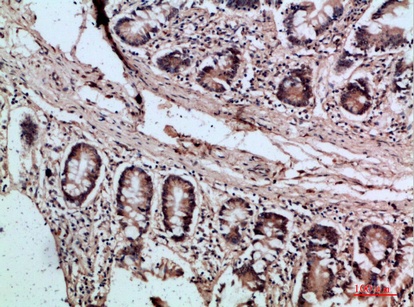 Fig.3. Immunohistochemical analysis of paraffin-embedded human-colon, antibody was diluted at 1:200.
