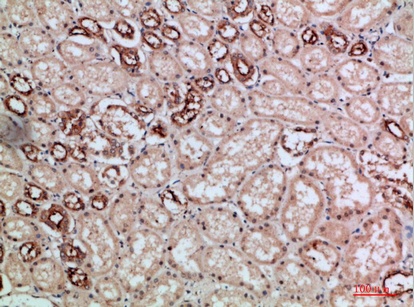 Fig.4. Immunohistochemical analysis of paraffin-embedded human-kidney, antibody was diluted at 1:200.