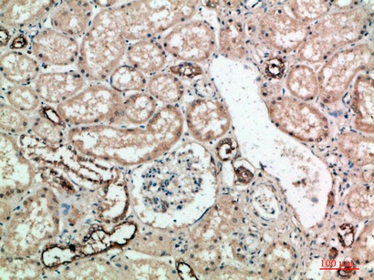 Fig.5. Immunohistochemical analysis of paraffin-embedded human-kidney, antibody was diluted at 1:200.