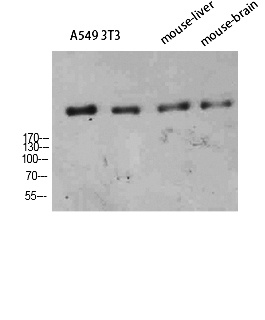 Fig. Western Blot analysis of A549 3T3 Mouse-liver Mouse-brain cells using CD35 Polyclonal Antibody diluted at 1:800. Secondary antibody (catalog#: A21020) was diluted at 1:20000.