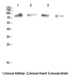 Fig. Western Blot analysis of Mouse-kidney Mouse-heart Mouse-brain cells using MUM1 Polyclonal Antibody diluted at 1:1000. Secondary antibody (catalog#: A21020) was diluted at 1:20000.