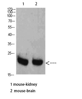 Fig. Western Blot analysis of Mouse-kidney Mouse-brain cells using RHEB Polyclonal Antibody diluted at 1:2000. Secondary antibody (catalog#: A21020) was diluted at 1:20000.