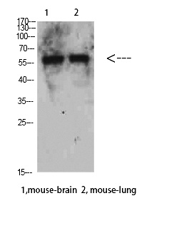 Fig. Western Blot analysis of Mouse-brain Mouse-lung cells using Beclin-1 Polyclonal Antibody diluted at 1:500. Secondary antibody (catalog#: A21020) was diluted at 1:20000.