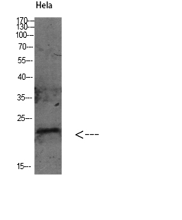 Fig. Western Blot analysis of various cells using Antibody diluted at 1:1000. Secondary antibody (catalog#: A21020) was diluted at 1:20000.