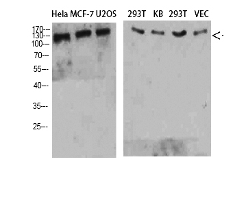 Fig. Western Blot analysis of Hela MCF-7 U2OS 293T KB 293T VEC cells using Collagen IV Polyclonal Antibody diluted at 1:800. Secondary antibody (catalog#: A21020) was diluted at 1:20000.