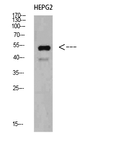 Fig. Western Blot analysis of HEPG2 cells using IgM Chain C Polyclonal Antibody diluted at 1:500. Secondary antibody (catalog#: A21020) was diluted at 1:20000.