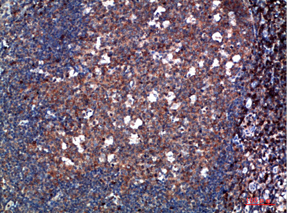 Fig.2. Immunohistochemical analysis of paraffin-embedded human-tonsil, antibody was diluted at 1:200.