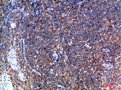 Fig.3. Immunohistochemical analysis of paraffin-embedded human-tonsil, antibody was diluted at 1:200.