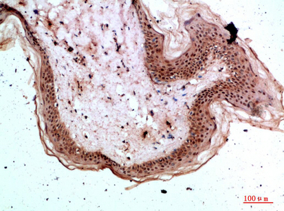 Fig.4. Immunohistochemical analysis of paraffin-embedded human-skin, antibody was diluted at 1:200.
