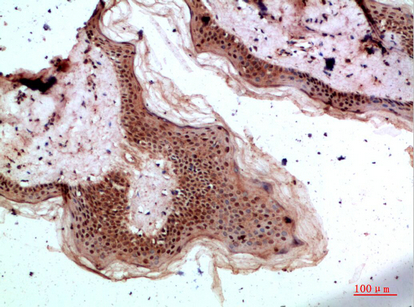 Fig.5. Immunohistochemical analysis of paraffin-embedded human-skin, antibody was diluted at 1:200.