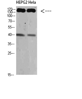 Fig.1. Western Blot analysis of HEPG2 Hela cells using CYFIP2 Polyclonal Antibody diluted at 1:500. Secondary antibody (catalog#: A21020) was diluted at 1:20000.