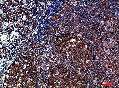 Fig.2. Immunohistochemical analysis of paraffin-embedded human-tonsil, antibody was diluted at 1:200.