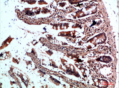 Fig.5. Immunohistochemical analysis of paraffin-embedded human-colon, antibody was diluted at 1:200.