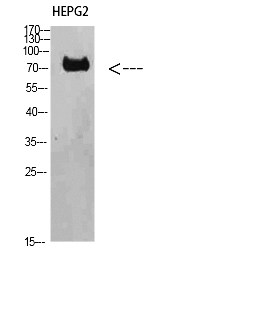 Fig.1. Western Blot analysis of HEPG2 cells using TRIF Polyclonal Antibody diluted at 1:1000. Secondary antibody (catalog#: A21020) was diluted at 1:20000.