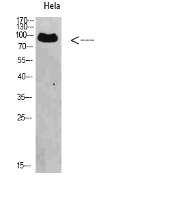 Fig. Western Blot analysis of Hela cells using VPS35 Polyclonal Antibody diluted at 1:500. Secondary antibody (catalog#: A21020) was diluted at 1:20000.