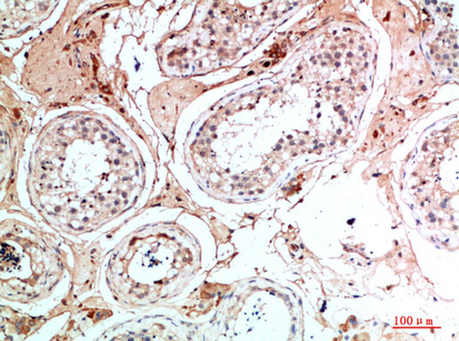 Fig.5. Immunohistochemical analysis of paraffin-embedded human-testis, antibody was diluted at 1:200.