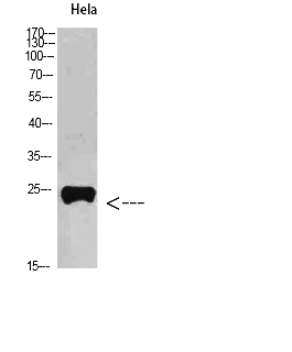 Fig. Western Blot analysis of Hela cells using PTH-rP Polyclonal Antibody diluted at 1:800. Secondary antibody (catalog#: A21020) was diluted at 1:20000.