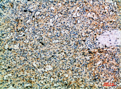 Fig.4. Immunohistochemical analysis of paraffin-embedded human-spleen, antibody was diluted at 1:200.