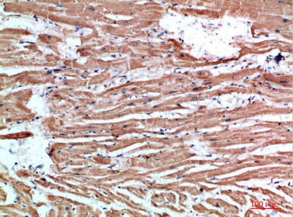Fig.3. Immunohistochemical analysis of paraffin-embedded human-heart, antibody was diluted at 1:200.