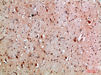Fig.4. Immunohistochemical analysis of paraffin-embedded human-brain, antibody was diluted at 1:200.