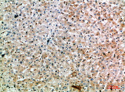 Fig.2. Immunohistochemical analysis of paraffin-embedded human-liver, antibody was diluted at 1:200.