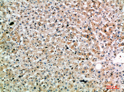 Fig.3. Immunohistochemical analysis of paraffin-embedded human-liver, antibody was diluted at 1:200.