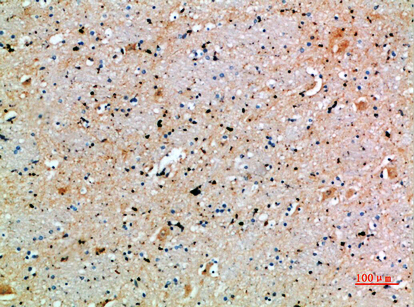 Fig.4. Immunohistochemical analysis of paraffin-embedded human-brain, antibody was diluted at 1:200.
