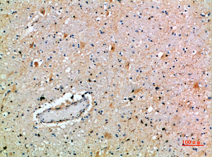 Fig.5. Immunohistochemical analysis of paraffin-embedded human-brain, antibody was diluted at 1:200.