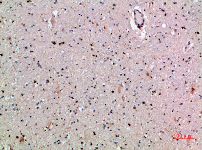 Fig.5. Immunohistochemical analysis of paraffin-embedded human-brain, antibody was diluted at 1:200.