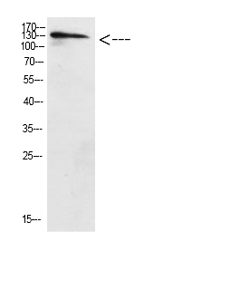 Fig. Western Blot analysis of HELA cells using Antibody diluted at 1:500. Secondary antibody (catalog#: A21020) was diluted at 1:20000.