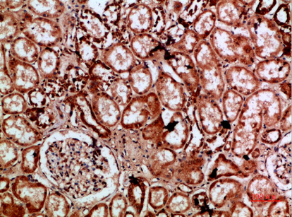 Fig.5. Immunohistochemical analysis of paraffin-embedded human-kidney, antibody was diluted at 1:200.