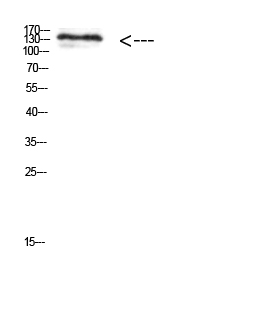 Fig.1. Western Blot analysis of 293t cells using Antibody diluted at 1:1000. Secondary antibody (catalog#: A21020) was diluted at 1:20000.