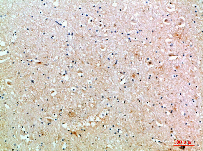 Fig.4. Immunohistochemical analysis of paraffin-embedded human-brain, antibody was diluted at 1:200.