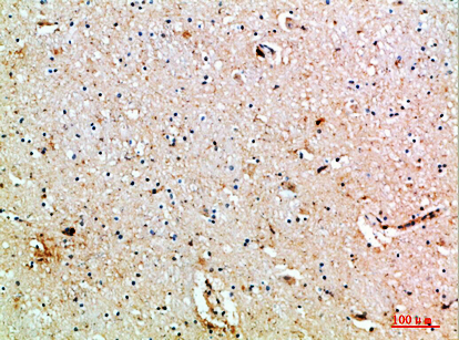 Fig.5. Immunohistochemical analysis of paraffin-embedded human-brain, antibody was diluted at 1:200.